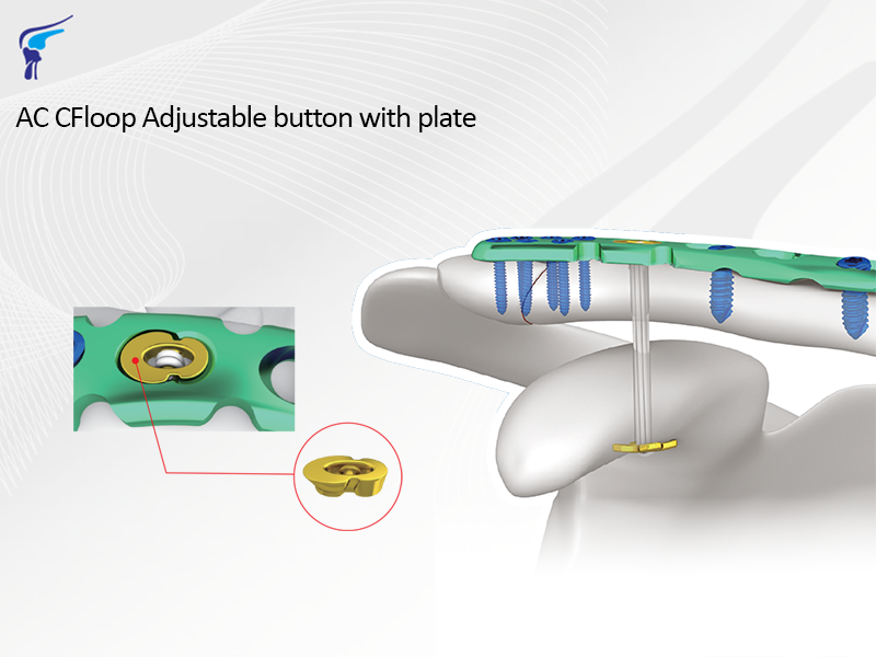 AC CFloop Adjustable Button With Plate