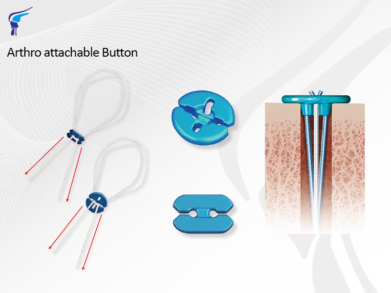 Arthro Attachable Button