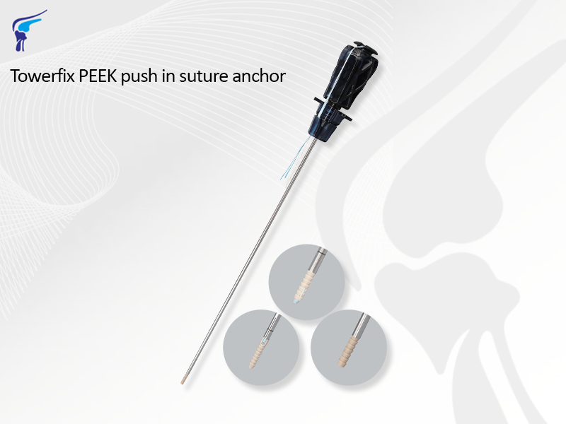 Towerfix PEEK Push In Suture Anchor