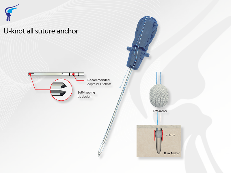 U-Knot All Suture Anchor